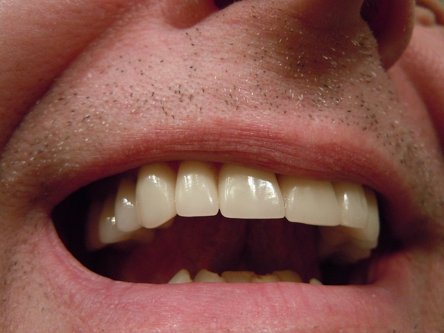 V vsakem primeru nam zobna protetika pomaga do lepih in zdravih zob