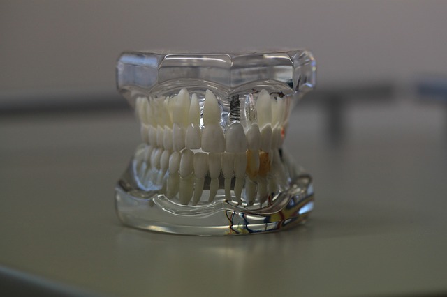 Najbolj opazni izdelki, ki jih ponuja zobna protetika, so gotovo vsadki in proteze, a to še zdaleč ni vse